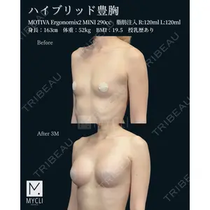 MYCLI【マイクリ】大阪・梅田院 三木 晶森医師の症例