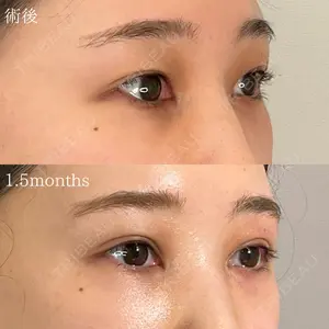 オーキッド美容クリニック東京御徒町 西浦 蘭子医師の症例