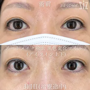ziz CLINIC 村岡 史子医師の症例