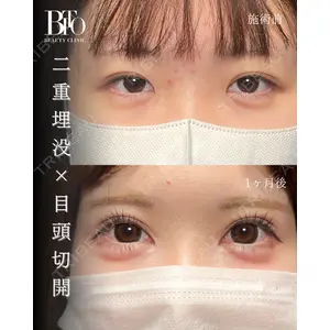BITO BEAUTY CLINIC 伊藤 富良野医師の症例