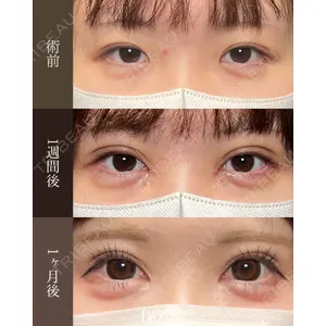 BITO BEAUTY CLINIC 伊藤 富良野医師の症例