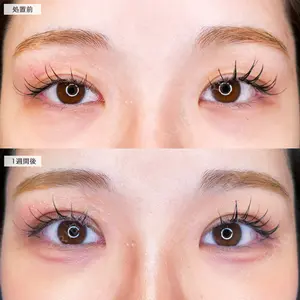 A CLINIC（エークリニック） 仙台院 伊藤 瑠桂医師の症例