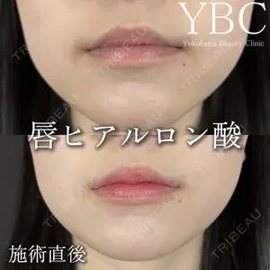 YBC横浜美容外科 池袋院 磯村 亮輔医師の症例