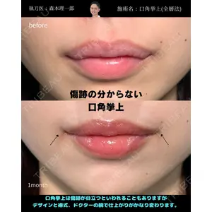 PRISM Beauty Clinic 町田院 森本 理一郎医師の症例