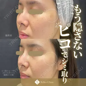 Fellez Clinic【フェルズクリニック】の症例