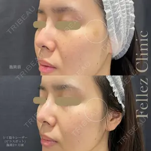 Fellez Clinic【フェルズクリニック】の症例