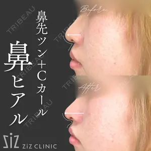 ziz CLINIC 村岡 史子医師の症例