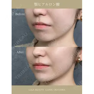 ルラ美容クリニック 岡山院 橋本 晃典医師の症例