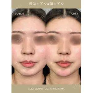 ルラ美容クリニック 岡山院 橋本 晃典医師の症例