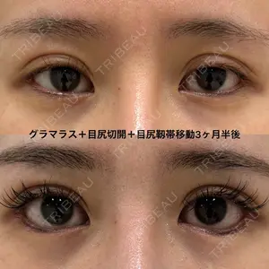 エターナル美容クリニック 久門田 詳医師の症例