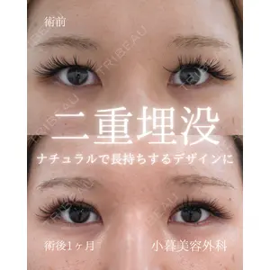 小暮整形外科・美容外科の症例