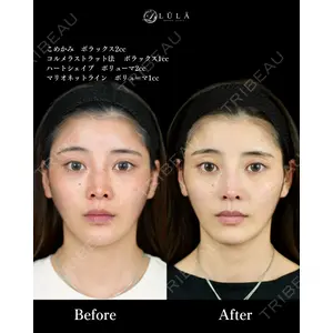 ルラ美容クリニック 池袋院 小海 元｜長期休暇につき指名不可医師の症例