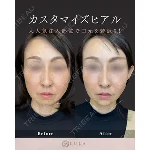 ルラ美容クリニック 名古屋栄院 / ルラスキンクリニック 名古屋栄院 関戸 優医師の症例