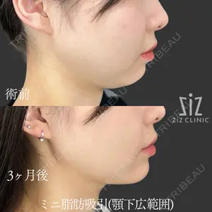 ziz CLINIC 村岡 史子医師の症例