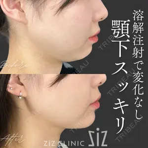 ziz CLINIC 村岡 史子医師の症例