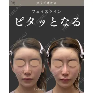 muni skin clinicの症例