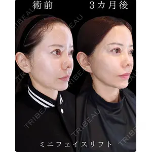 HAAB BEAUTY CLINIC 南青山本院（新院） 小平 佳典医師の症例