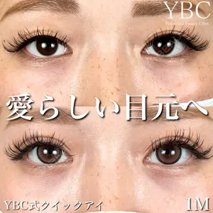 YBC横浜美容外科 池袋院 磯村 亮輔医師の症例
