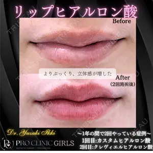 PRO CLINIC プロクリニック 銀座院 柚﨑 一輝医師の症例