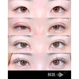 東京シンデレラ美容外科 池袋院 石井 達也医師の症例