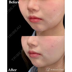 AI Beauty Clinic （エーアイ美容クリニック） 尾崎 宥文医師の症例