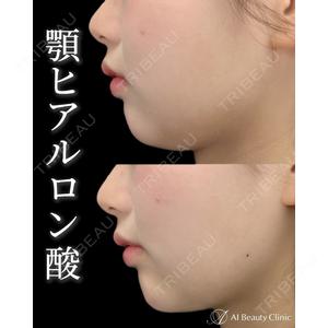 AI Beauty Clinic （エーアイ美容クリニック） 尾崎 宥文医師の症例