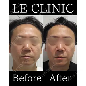 LE CLINICの症例