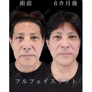 HAAB BEAUTY CLINIC 南青山本院（新院） 小平 佳典医師の症例