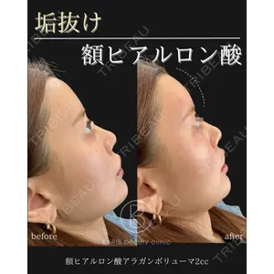 KARIS beauty clinic 滝内 ヒロフミ医師の症例