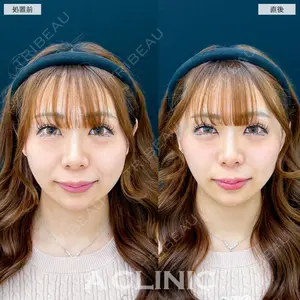 A CLINIC（エークリニック） 新宿院 瀬戸　翔太医師の症例