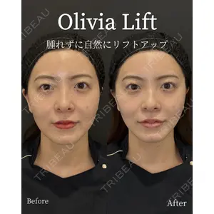 Olivia Clinic 中原 良介医師の症例