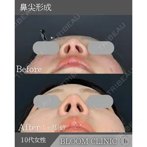 ブルームクリニック（BLOOM CLINIC）の症例