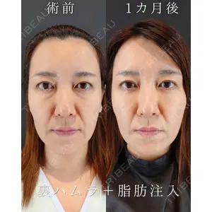 HAAB BEAUTY CLINIC 南青山本院（新院） 小平 佳典医師の症例