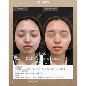 Clinic9の症例
