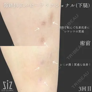 ziz CLINIC 村岡 史子医師の症例