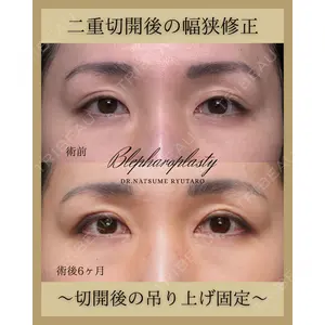 池袋麗歯科・美容皮膚科 夏目 隆太郎医師の症例
