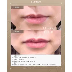 Clinic9の症例