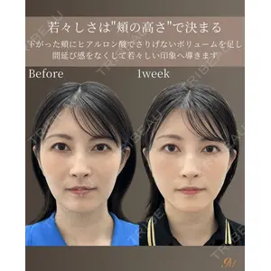gift clinic 能登谷 翔医師の症例