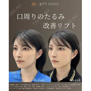 gift clinic 能登谷 翔医師の症例