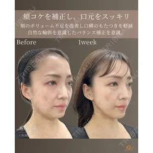 gift clinic 能登谷 翔医師の症例