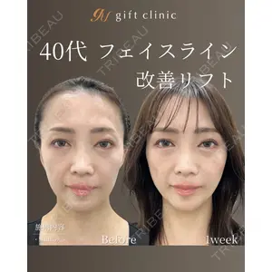 gift clinic 能登谷 翔医師の症例