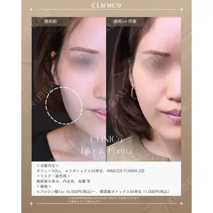 Clinic9の症例