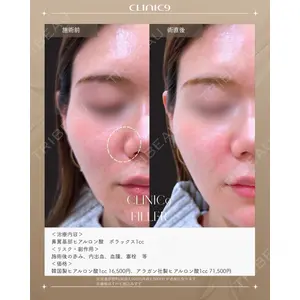 Clinic9の症例