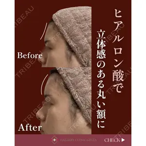 ギャラリークリニック 銀座の症例