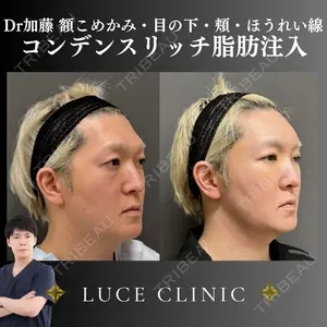 ルーチェクリニック 銀座院 加藤晴之輔医師の症例