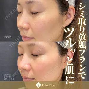 Fellez Clinic【フェルズクリニック】の症例