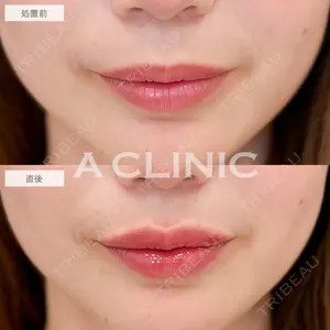 A CLINIC（エークリニック） 新宿院 瀬戸　翔太医師の症例