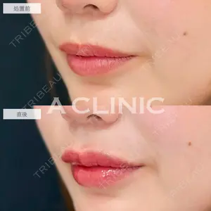 A CLINIC（エークリニック） 新宿院 瀬戸　翔太医師の症例