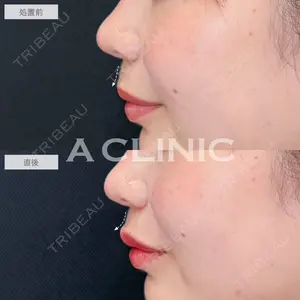 A CLINIC（エークリニック） 新宿院 瀬戸　翔太医師の症例