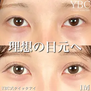 YBC横浜美容外科 池袋院 磯村 亮輔医師の症例